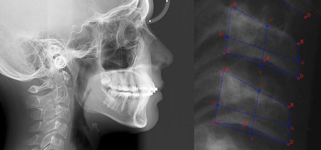 ai-xray